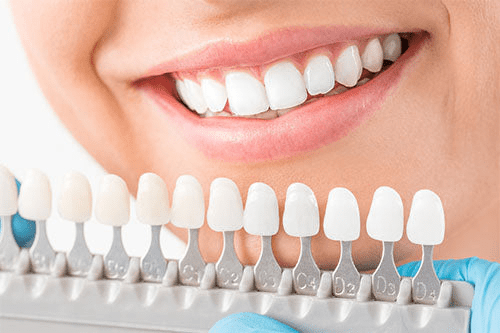 Dental Veneers Cost: Understanding Prices and What to Expect